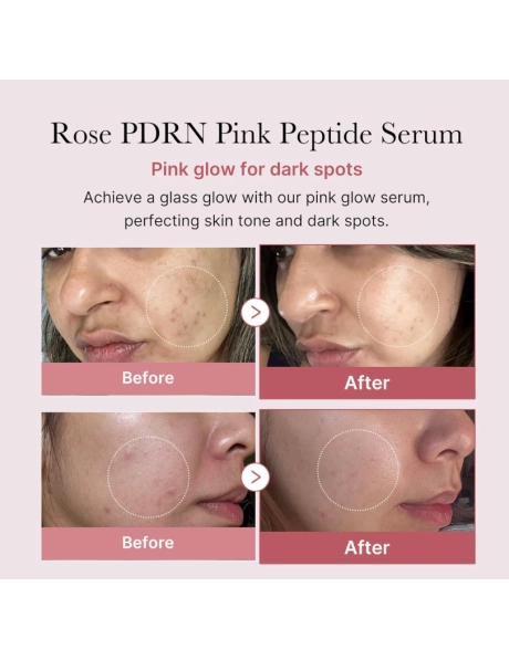 Medicube PDRN Pink Peptide Serum 30ml