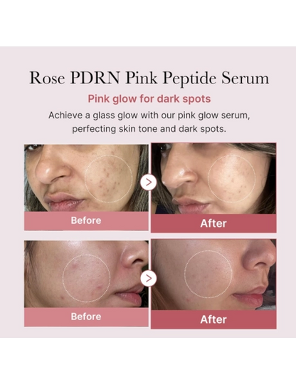 Medicube PDRN Pink Peptide Serum 30ml